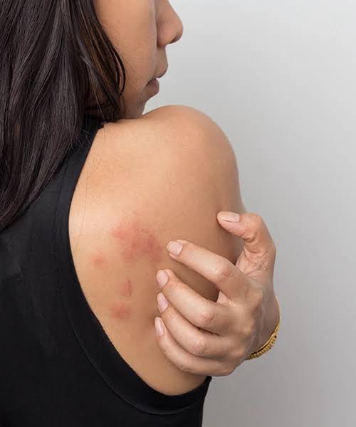Skin Conditions care with a Lyla Health clinician